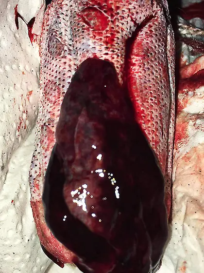 another day and a menstrual clot on my tampon