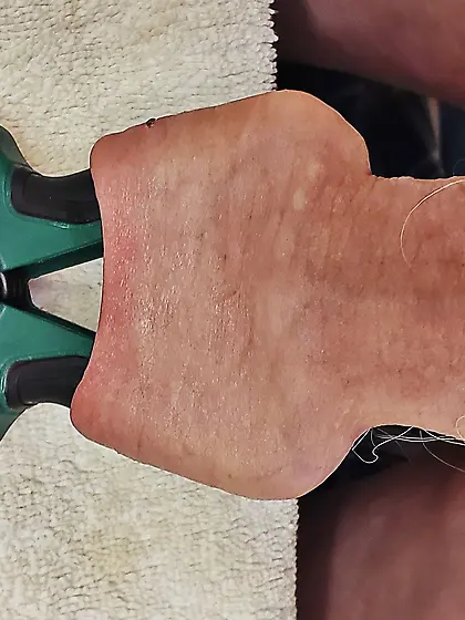 Foreskin Torture and Stretch