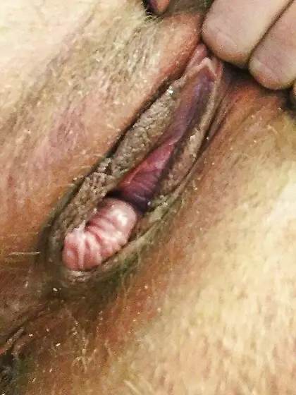 Tracy shared by loving husband