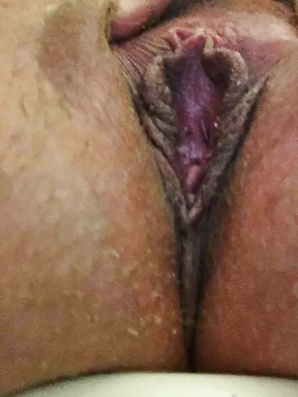 Tracy shared by loving husband