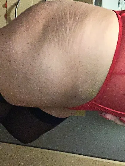 Postoperative Sklavin