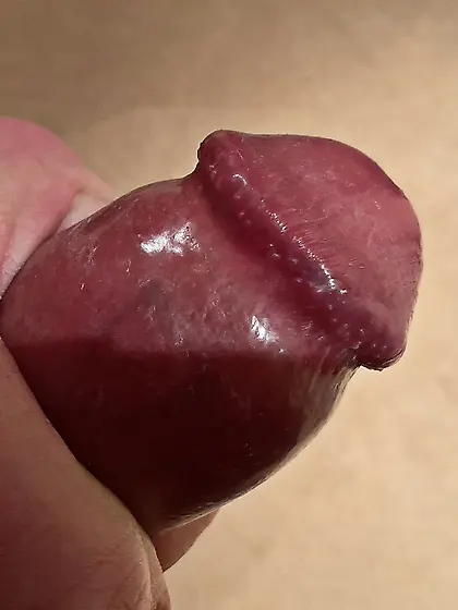 Estim,  foreskin stretched back,  glans cbt