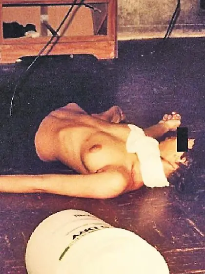 Autoerotic asphyxiation gone wrong 6