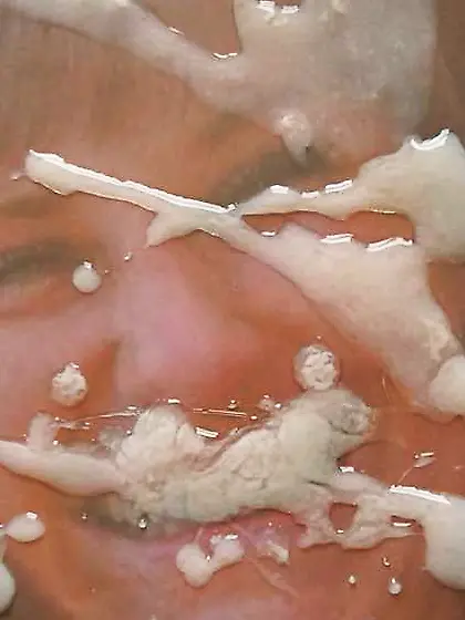 Zoe gets another TosserTim pasting