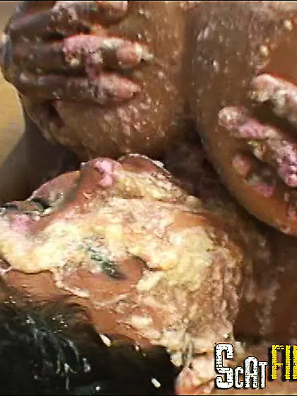 Scat Vomit Asshole Sluts