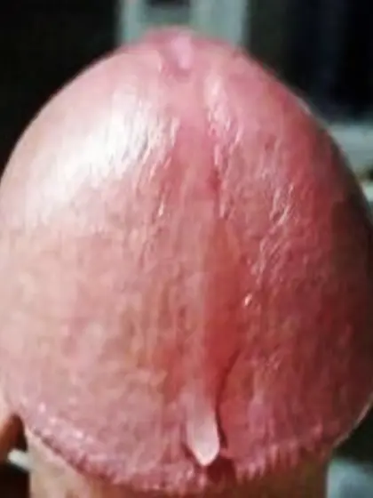 My cock head