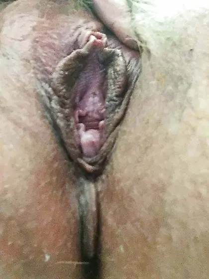 Tracy shared by loving husband