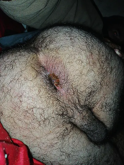 My dirty asshole