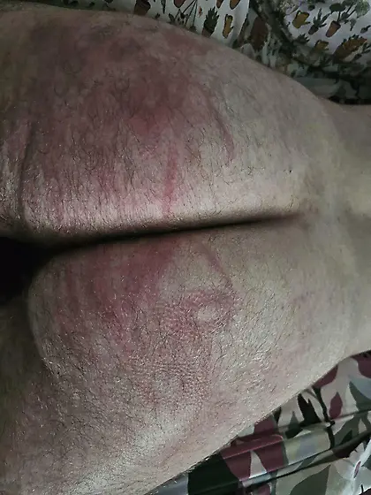 My ass after getting beat