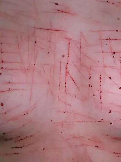 【R's Breast Cuts Collection】