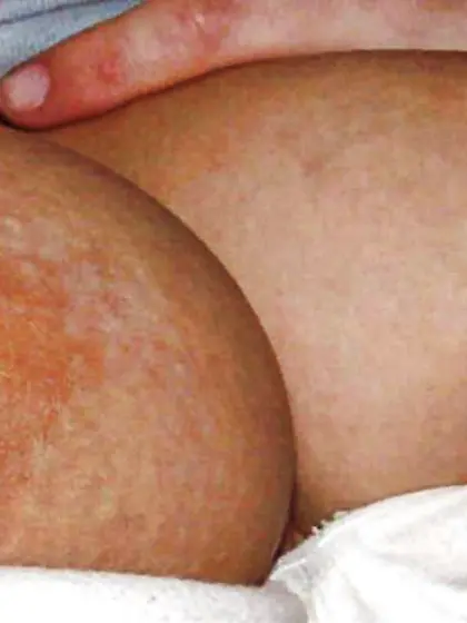 Fun Bags,  Puffies, Coochie,  Muschi