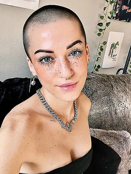 Bald girl