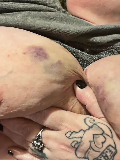 Tit zapping ⚡️⚡️⚡️