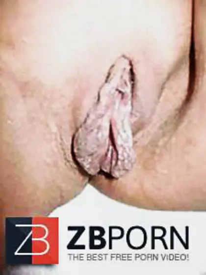 Grosse heraushaengende Schamlippen