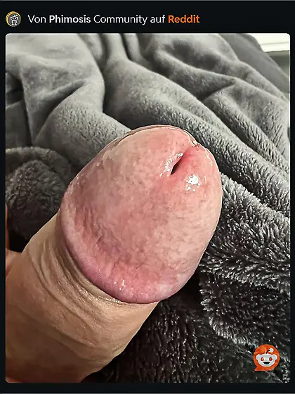 My own 18yo German Teen Penis