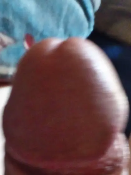 Purple dick head