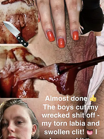 Done! The boys cut my wrecked clit and labia off!