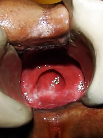 Asshole opened up wide