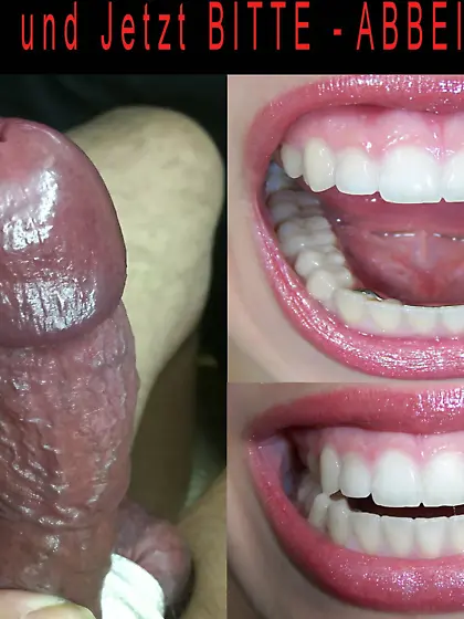 Penectomy Fantasie für meinen Schwanz