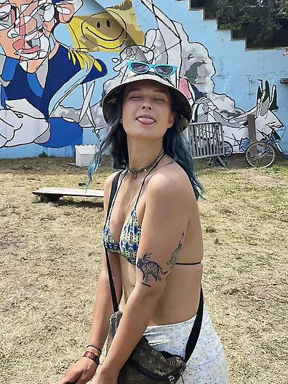 20 Year Old With Messed Up Tits.