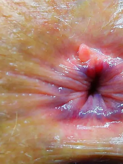 My Raw Blue Butt Hole Love The Shades