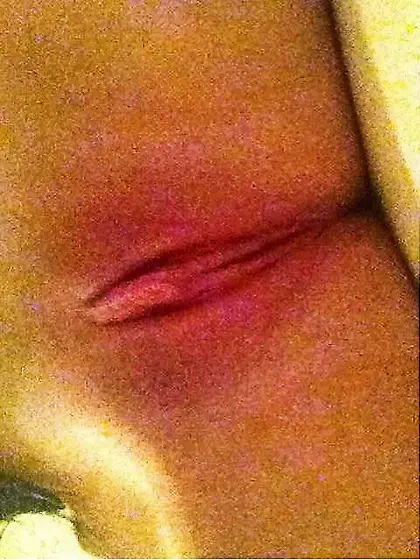 Caitlin Banning - Kenora