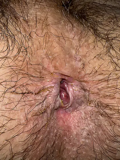 His Ugly hairy dirty anus