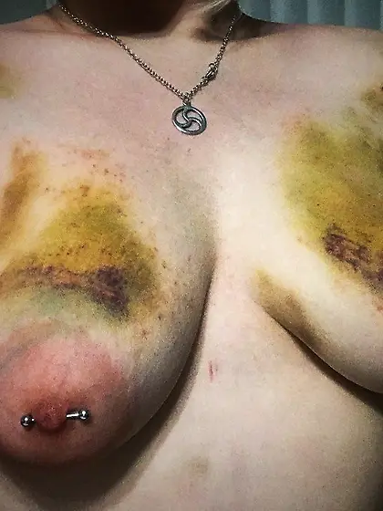 Worse than she hoped