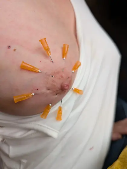 Nipple Needles 2