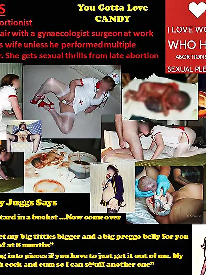 Late Term Abortion - Candy Juggs