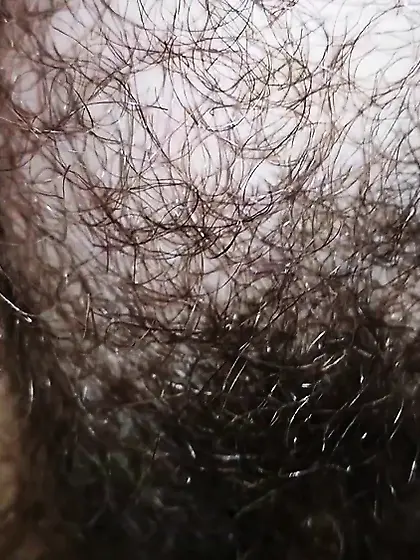 hairy bush