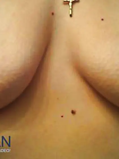 Huge Firm Puffies after the shower.