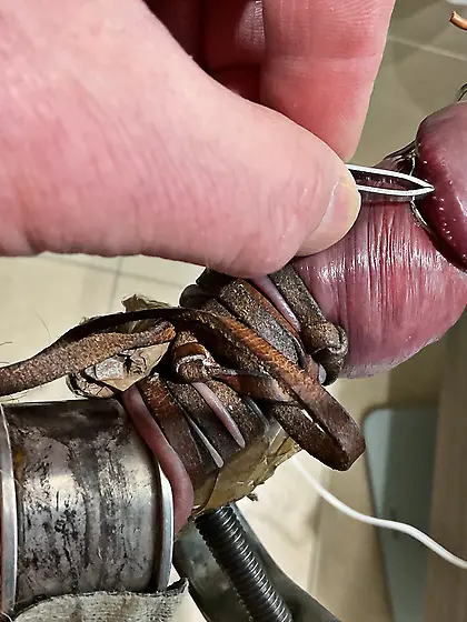 Estim ripping off papules from glans corona