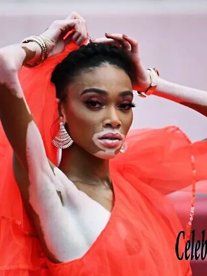 Winnie Harlow Erotic
