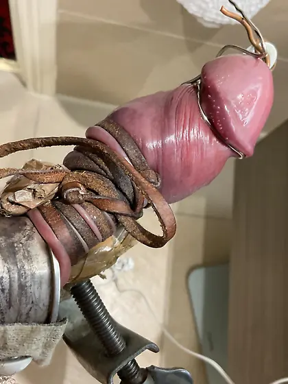 Estim ripping off papules from glans corona