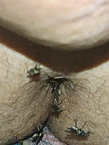 Flies on my anus in the village.  06. 2025