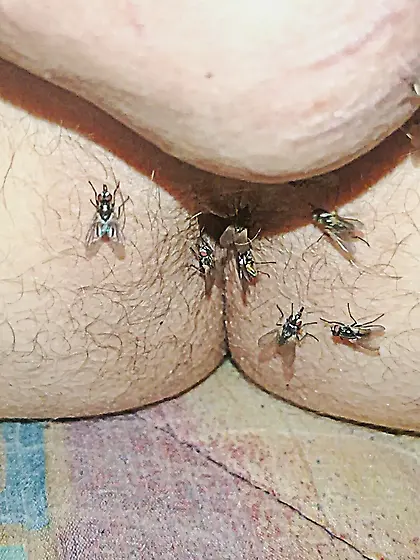 Flies on my anus in the village.  06. 2025