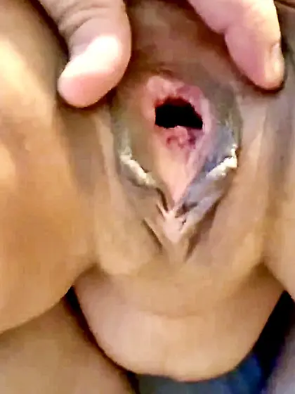 Random gape