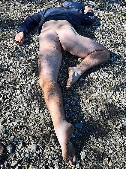 Andy sedated Gymnast 17