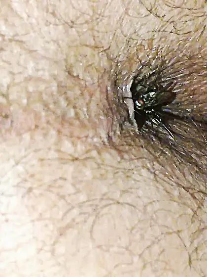 Flies on my anus in the village.  06. 2025