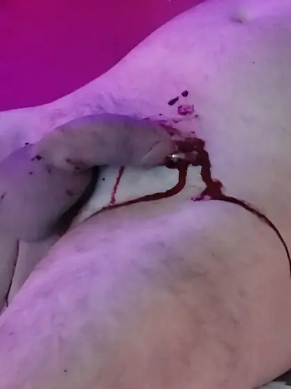 Heavy and bloody needle play on my poor cock.