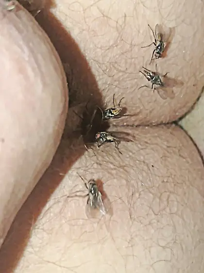 Flies on my anus in the village.  06. 2025