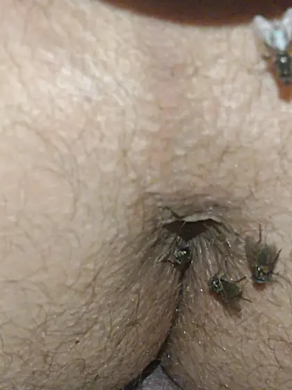 Flies on my anus in the village.  06. 2025