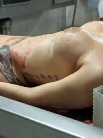 Morgue,  tits,  autopsy