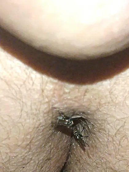 Flies on my anus in the village.  06. 2025