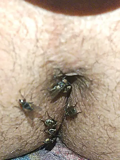 Flies on my anus in the village.  06. 2025