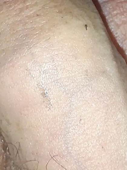 Flies on my anus in the village.  06. 2025