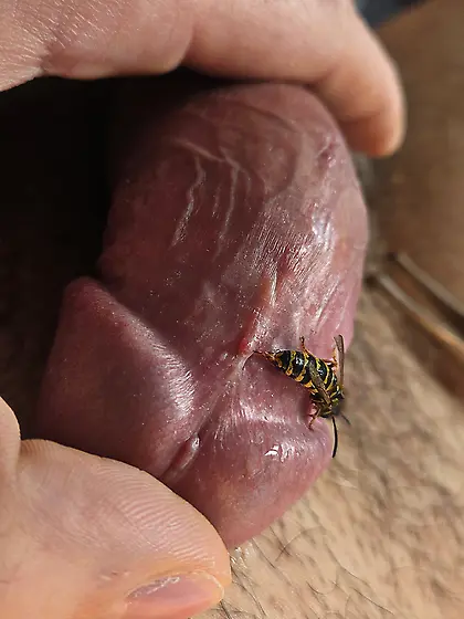 Let a vasp sting me (again)