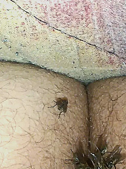 Flies on my anus in the village.  06. 2025