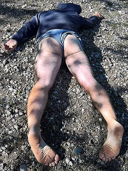 Andy sedated Gymnast 12